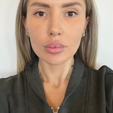 MS