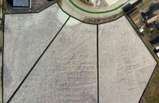 20557755