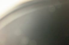 24607810