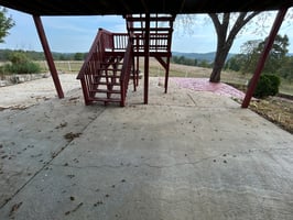 31633915
