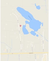 27941776