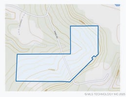 28998940