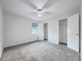 29351855