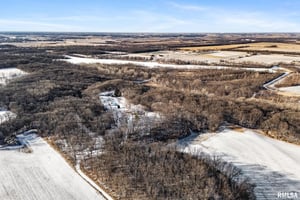 29571474