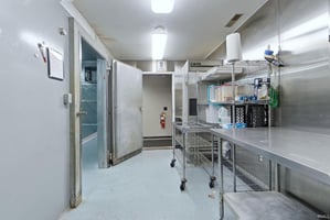 30079416