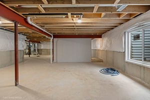 30099335