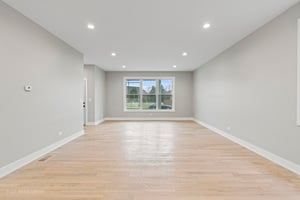 30099308