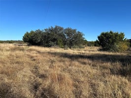 31275277