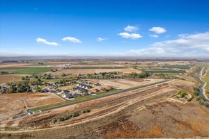 31615664