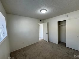 32277180