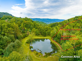 32422852