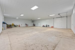 9887335